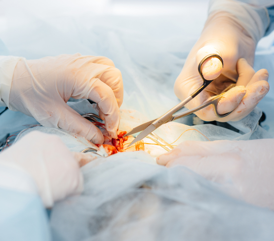 Chirurgie oncologique