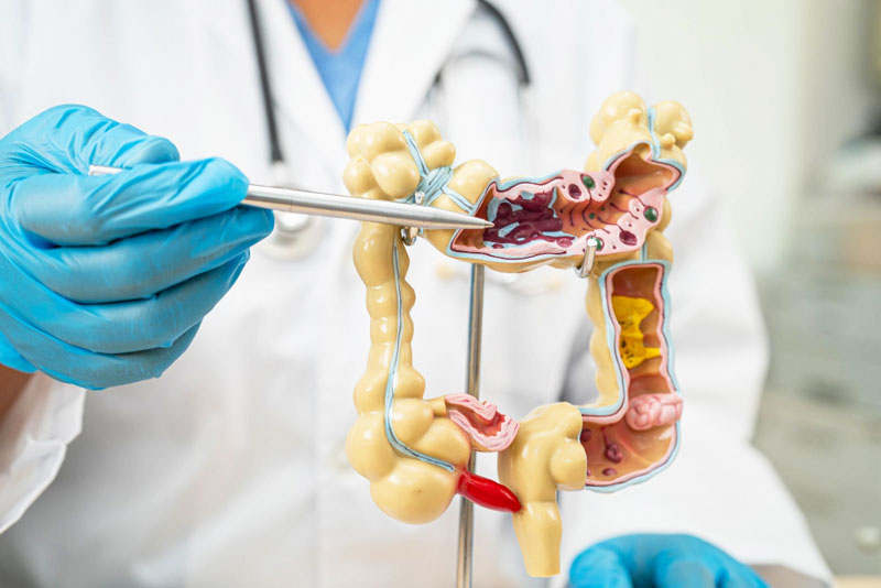 Chirurgie colorectale