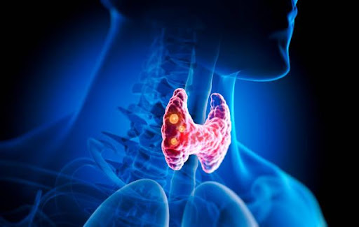 Chirurgie des glandes parathyroïdes