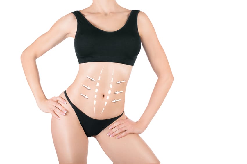 Éventration abdominale Tunisie